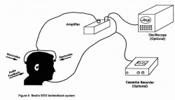 Fig. 5. Beck's EEG biofeedback system.