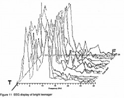 Fig. 11. EEG display of bright teenager.